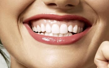 Smile teeth